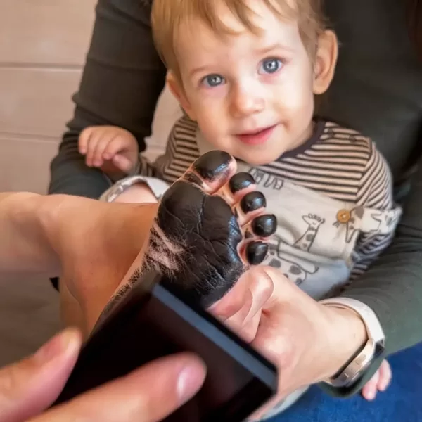 Mažų pėdučių procesas